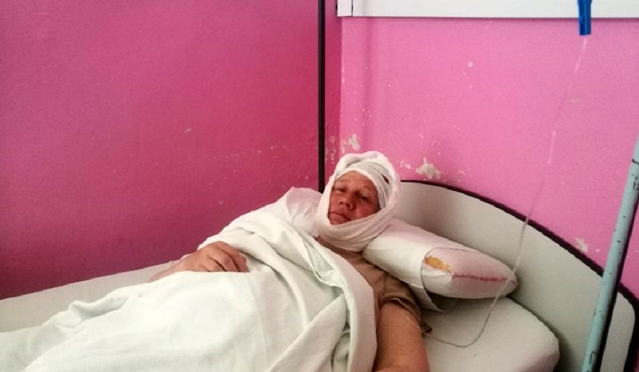La Ingeniera Alejandra Portatadino, de Tierra del Fuego, fue trasladada a la guardia del Hospital Zonal de Bariloche. Estuvo consiente con un corte en la cabeza y un traumatismo de crneo. Foto: barilobarilonoticias.com. 