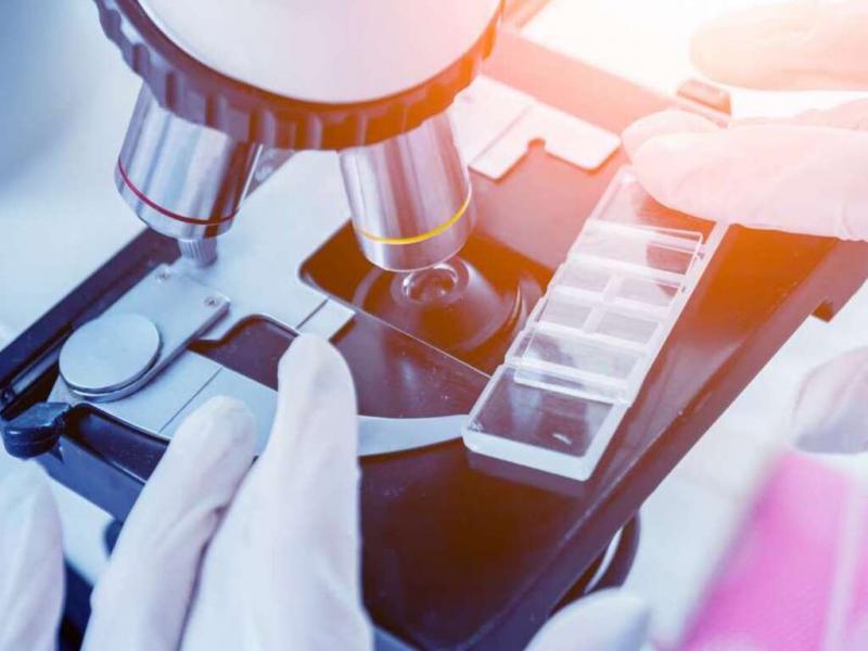 Los anticuerpos son protenas que el organismo produce de manera natural para reconocer agentes infecciosos o clulas alteradas y que puedan ser eliminadas por los linfocitos del sistema inmune (glbulos blancos de la sangre).